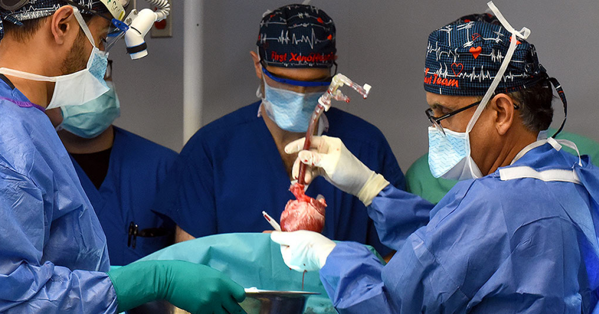 Трасплантація серце операція